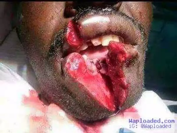 Wife Allegedly Slices Husband Lips For Sending His Mistress Money (Very Graphic Photo)